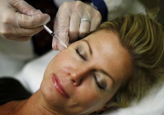 Zavedenie výplní do pokožky tváre - injekčná metóda napínania