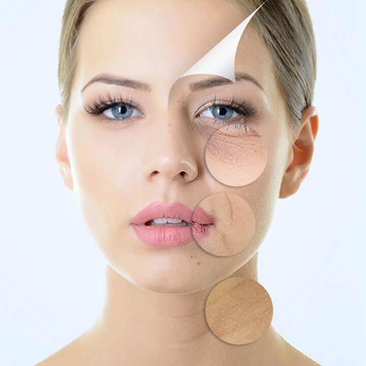 Nedokonalosti pokožky tváre - indikácie procedúr proti starnutiu